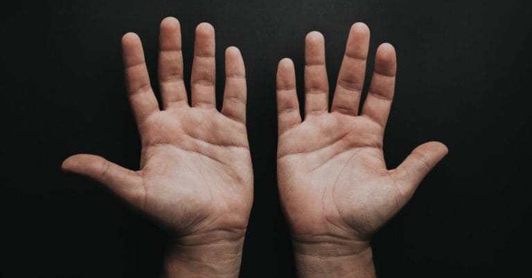 Managing Eczema Naturally Without Steroids